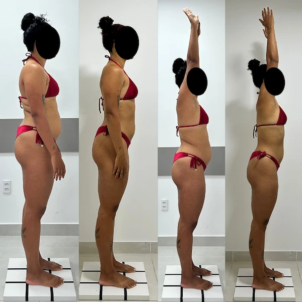 Evolução 02